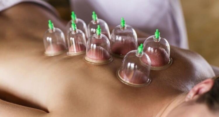 Do’s & Don’ts Before and After Hijama